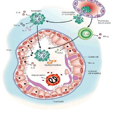 A Simple Example Of Dysregulated Cytokines Cytokine Dysregulation In