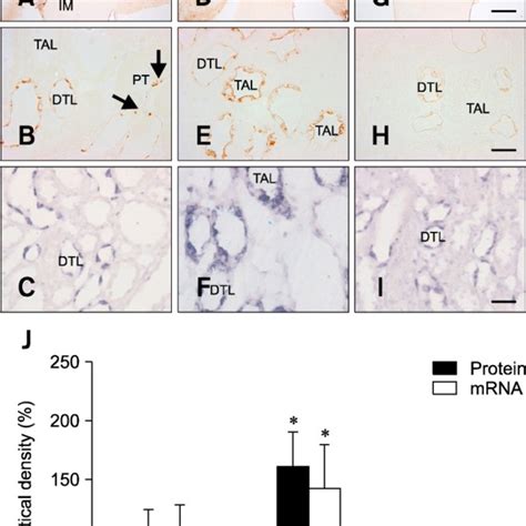 Light Micrographs Illustrating Opn Immunostaining And In Situ