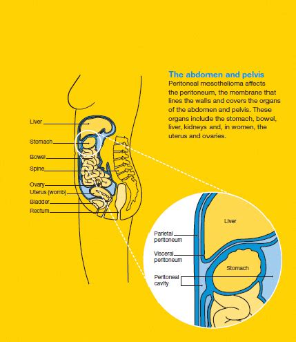 How To Biopsy Lung Nodule