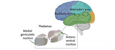 Schizophrenia: When the thalamus misleads the ear - Neuroscience News