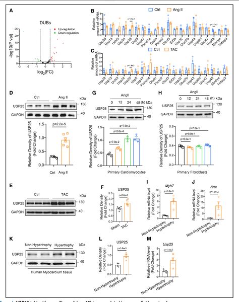 Figure From Usp Ameliorates Pathological Cardiac Hypertrophy By