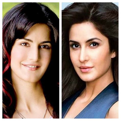 Katrina Kaif Before After Plastic Surgery Makeover Dr Niketa Sonavane