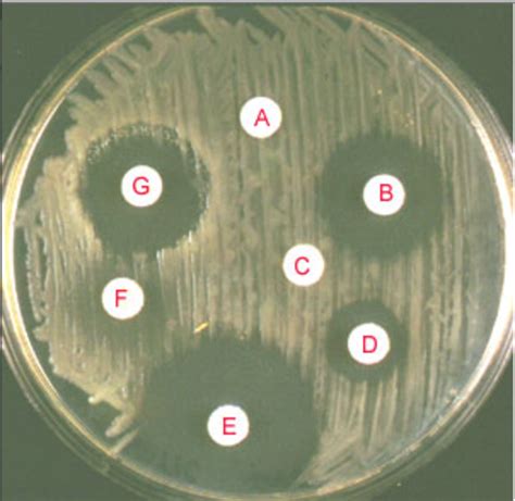 How To Measure Antibiotic Zone Of Inhibition