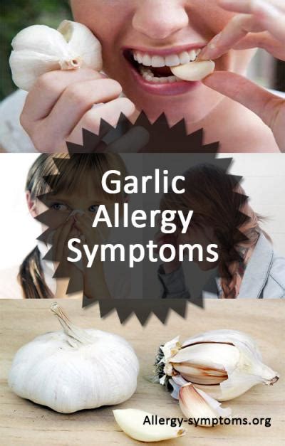 Garlic Allergy Symptoms and Diagnosis - Allergy Symptoms