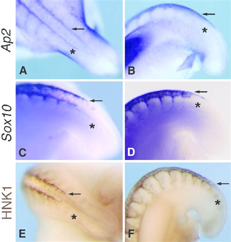 Early Migration Of Secondary Neural Crest Cells In Hh Chick