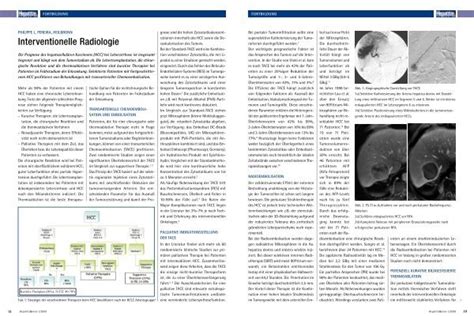 Minimal Invasive Therapie Des Leberkrebs Von Prof Pereira