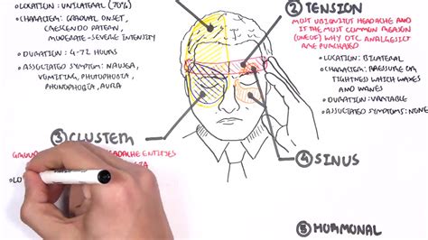 Headache - Overview (types, signs and symptoms, treatment)