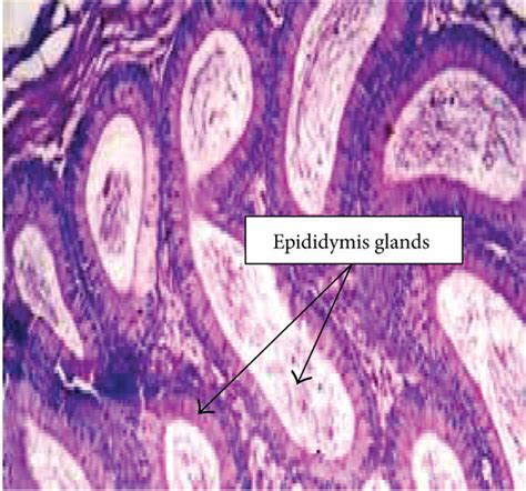 The Histological Examination Of Both Testicular And Epididymal Tissues