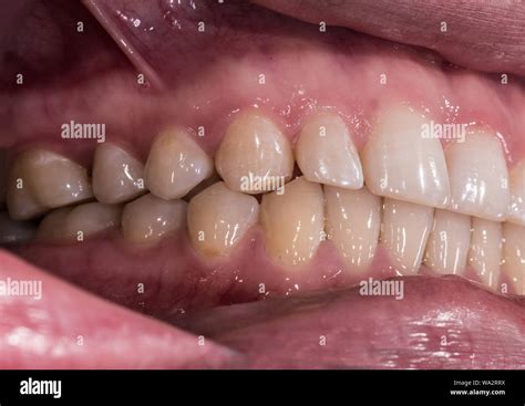 normal morphology  res stock photography  images alamy