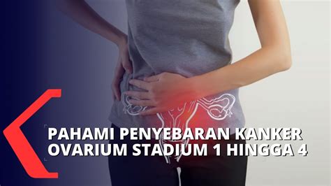 Begini Kondisi Penyebaran Kanker Ovarium Stadium 1 Hingga 4 Youtube