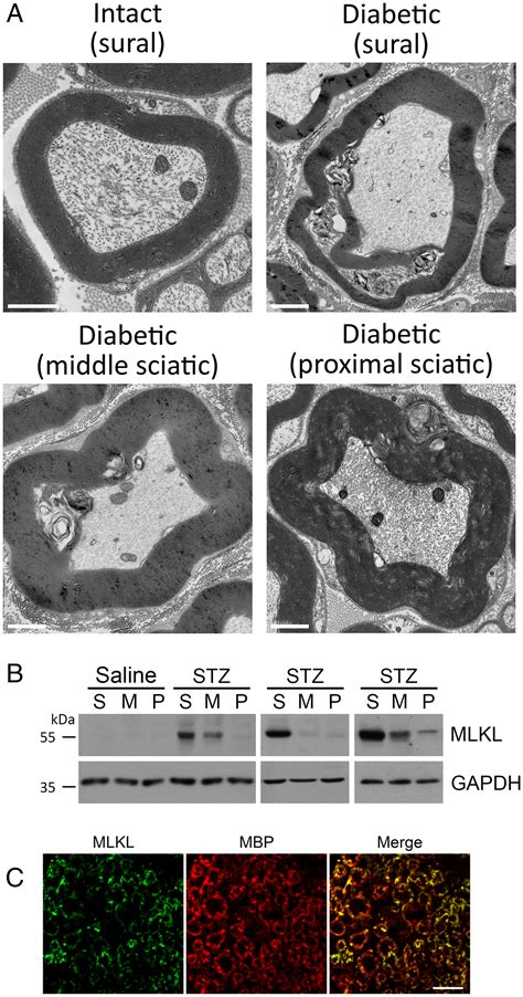 Blockage Of Mlkl Prevents Myelin Damage In Experimental Diabetic