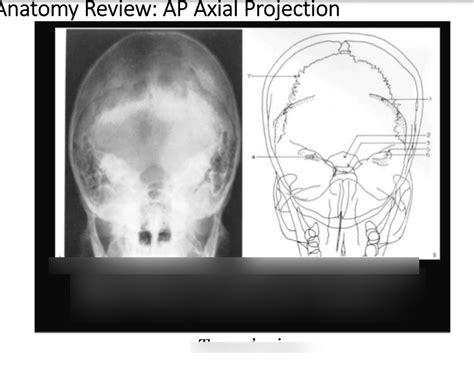 AP Axial Town X Ray Part 2 Diagram Quizlet