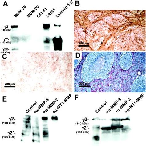 Cooperative Interactions Of Laminin 5 γ2 Chain Matrix