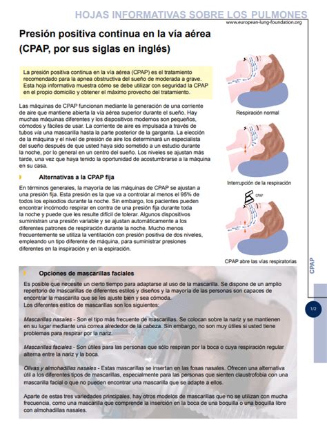 Infograf A Basada En Evidencias Uso De La Presi N Positiva En La V A