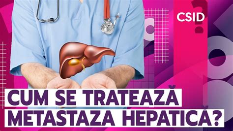 Metastazele Hepatice De Ce Apar I Cum Se Trateaz Youtube