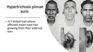 Sex Linked Traits Pptx Genetics Science