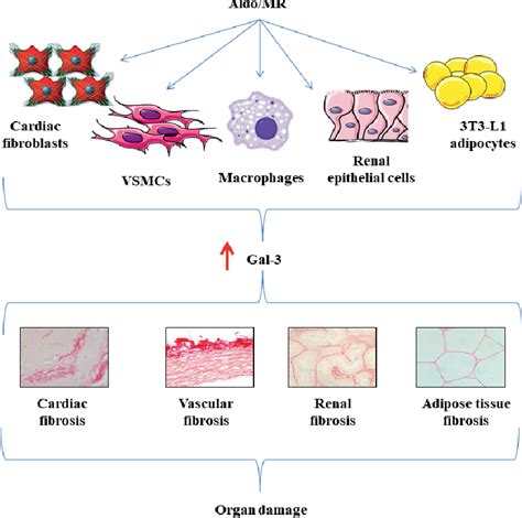 Figure 1 From Aldosterone Mineralocorticoid Receptor Downstream Targets