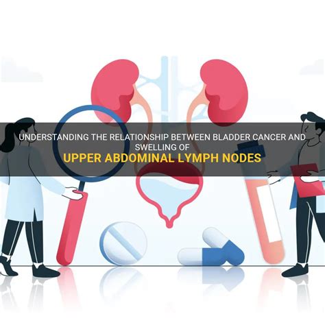 Understanding The Relationship Between Bladder Cancer And Swelling Of Upper Abdominal Lymph