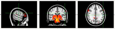 -Functional magnetic resonance imaging at resting state. | Download ...