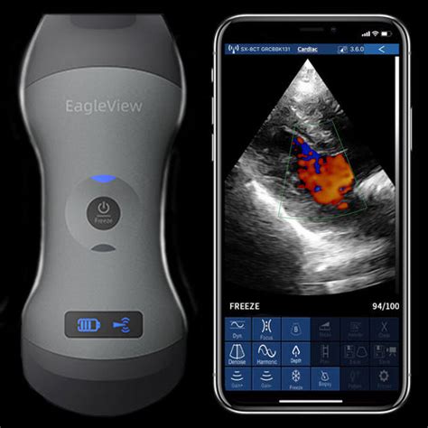 EagleView Dual-Head Wireless Handheld Ultrasound