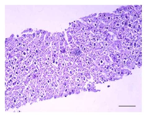 Histology Of Liver Slices In Culture Histology Of Transversal A B