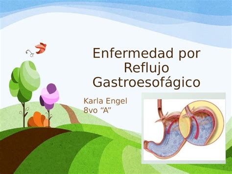 Pptx Enfermedad Por Reflujo Gastroesofágico Dokumen Tips