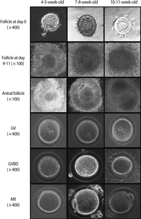 Microphotographs Showing In Vitro Growth Of Mouse Preantral Follicles Download Scientific