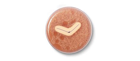 Benefits Of Ethicon Plus Antimicrobial Triclosan Coated Sutures Ethicon