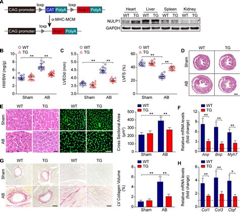 NULP1 Alleviates Cardiac Hypertrophy By Suppressing NFAT3