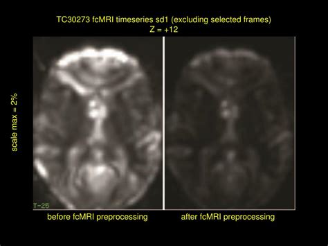 Ppt Resting State Fmri Rs Fmri Fcmri Physiological Underpinnings