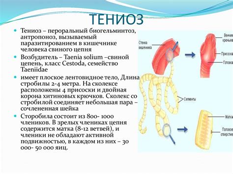 Гельминтозы - online presentation