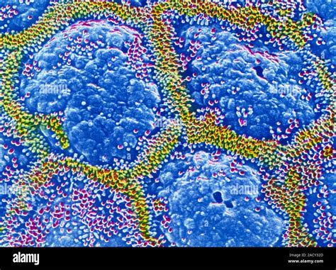 Stomach Lining Coloured Scanning Electron Micrograph Sem Of The