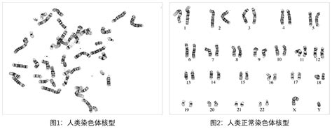 细胞染色体核型分析