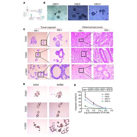 | YAP inhibitor modulates cell phenotype and proliferation in colon ... 