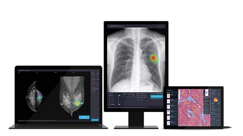 Lunit Chest X Ray Screening Tool Helps Detect Covid Symptoms