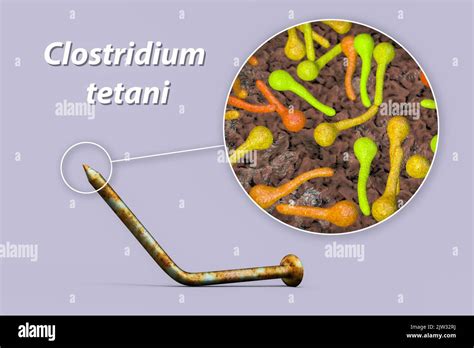 Transmission Of Tetanus Bacteria Conceptual Illustration Showing An