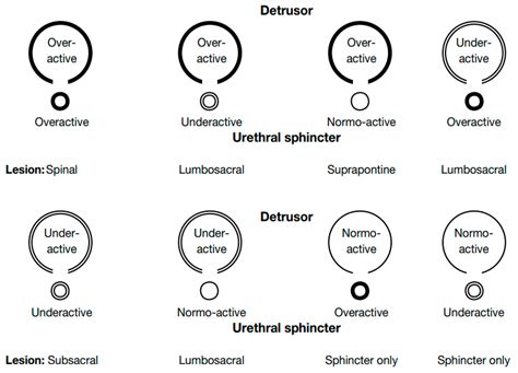 Jcm Free Full Text Neurologic Urinary Incontinence Lower Urinary Tract Symptoms And Sexual