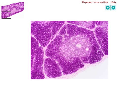 thymus histology Diagram | Quizlet