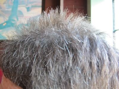 Scientists May Have Finally Figured Out Why Hair Turns Gray And How