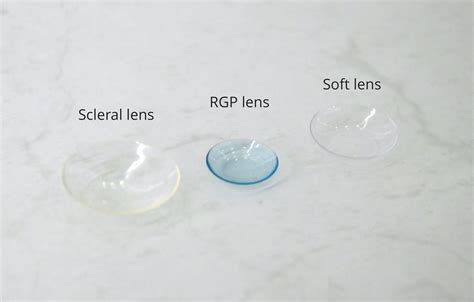 Contact Lenses For Every Vision Need Innovative Eye Care