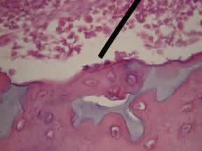 Osteoblast Wikidoc