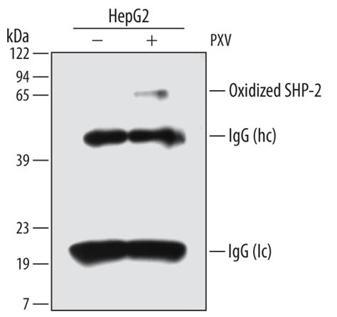 Oxidized PTP Active Site Research Products Novus Biologicals