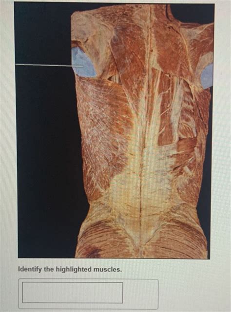 Solved Identify The Highlighted Muscles Chegg