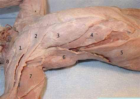 Ventral Diagram Quizlet