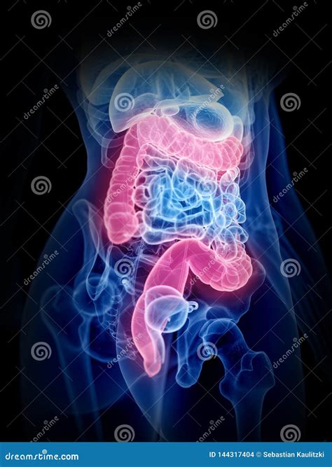 A Womans Inflamed Stomach Royalty-Free Illustration | CartoonDealer.com