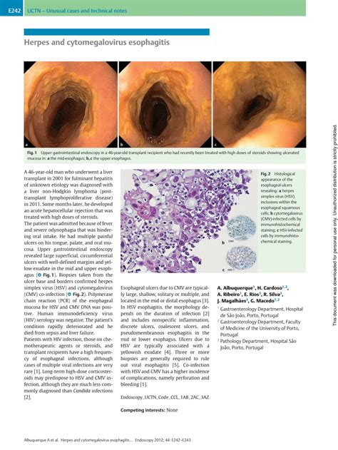 PDF Herpes And Cytomegalovirus Esophagitis