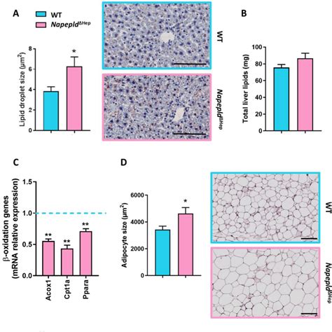 Figure From Hepatic Nape Pld Is A Key Regulator Of Liver Lipid