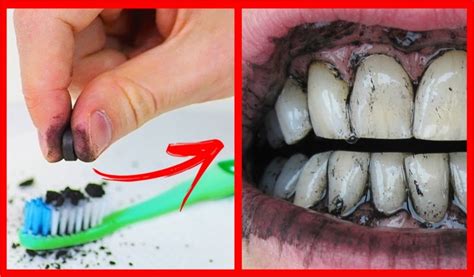 Como Clarear Os Dentes Em Casa Em 2 Minutos Receitas Caseiras Dicas