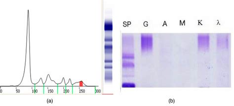 The Results Of The Second Serum Protein Electrophoresis And