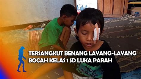 Ponorogo Tersangkut Benang Layang Layang Bocah Kelas Sd Luka Parah